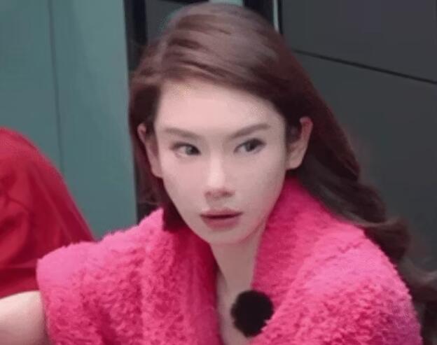 戚薇大方承认过度医美 称打肉毒打僵眉毛